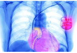 Circuit checkers for medical devices